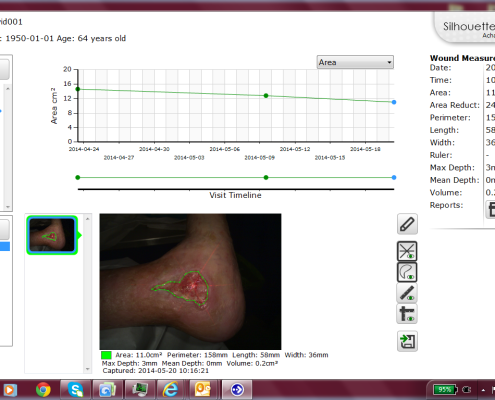 Silhouette digital wound assessment nursing tech fund