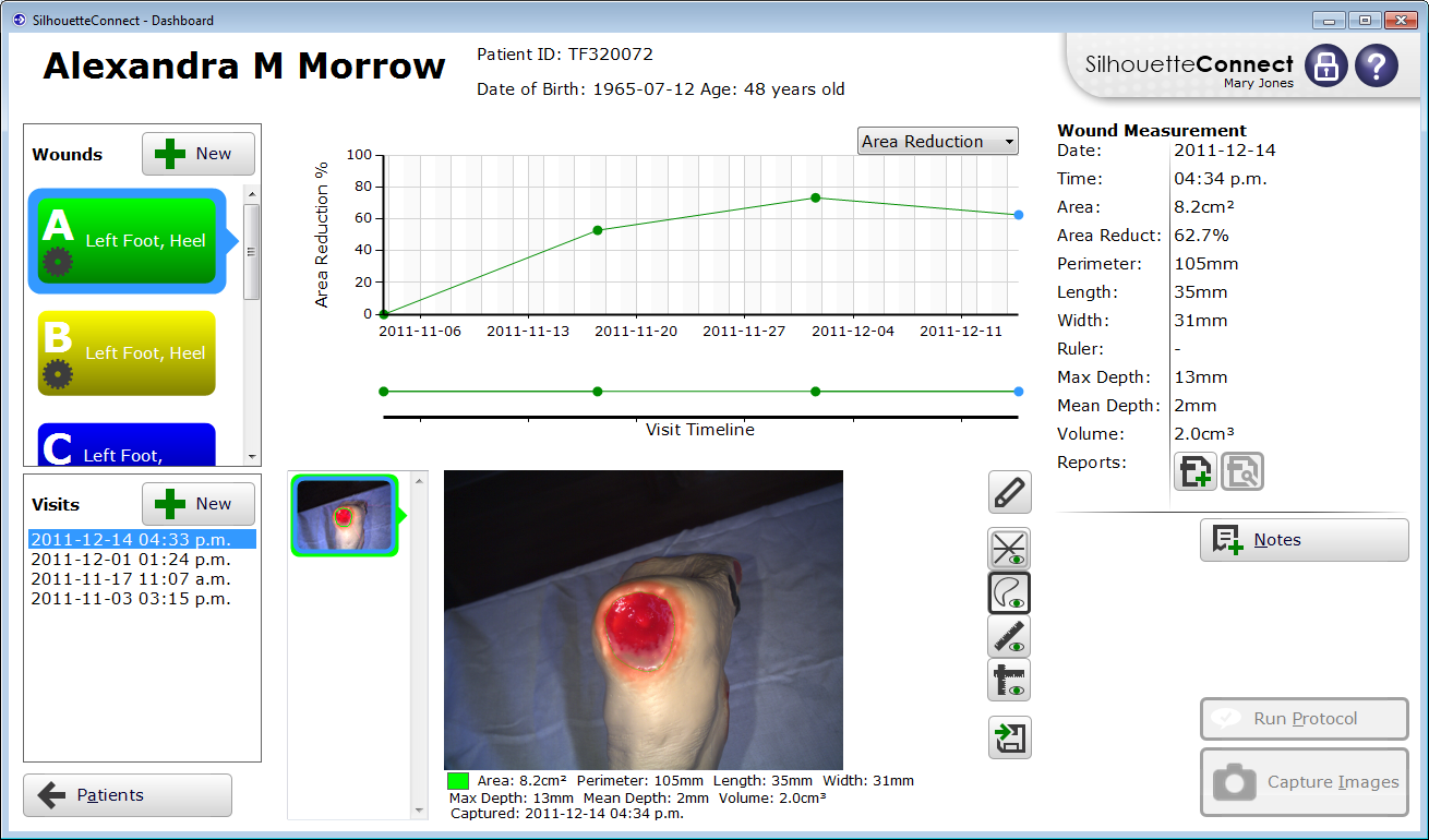 SilhouetteConnect__PatientDashboard__change_in__area